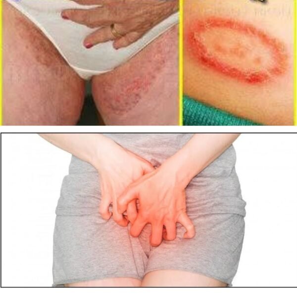 এলার্জি-চর্মরোগ নিরাময়-Allergy-niramoy - Image 4