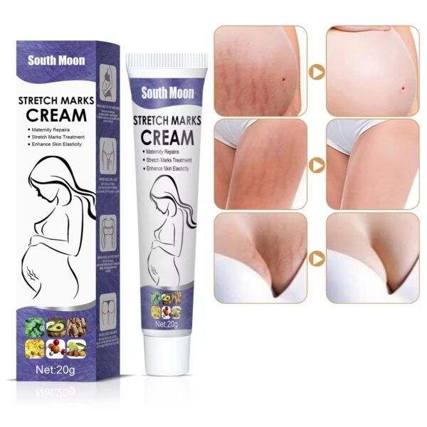 (2 piece) Stretch Marks Remover Cream - Image 4