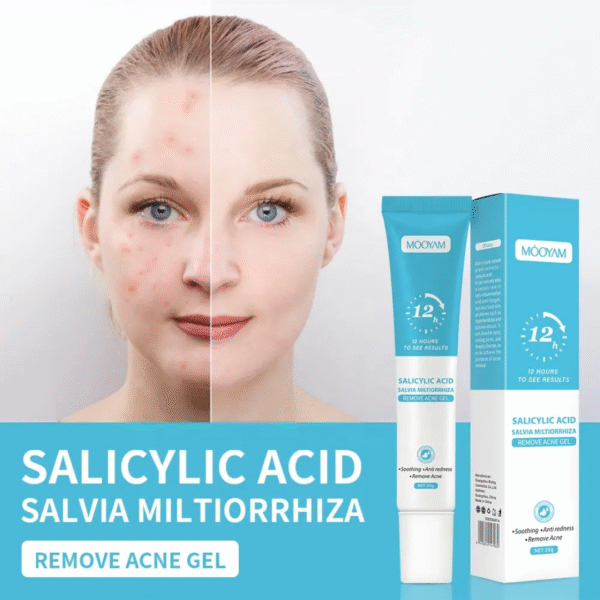 Remove Acne Gel – Salicylic Acid [2 Piece] - Image 2