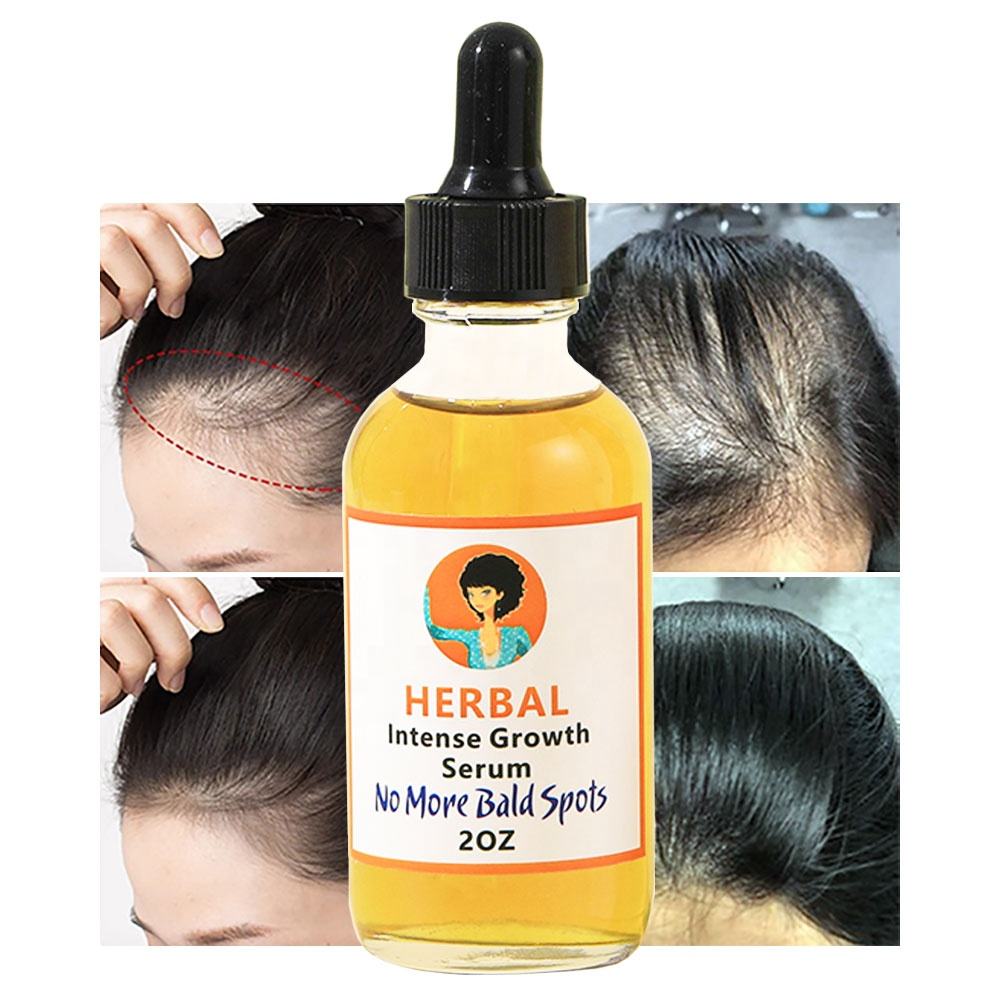Herbal Intense Hair Growth Serum - Image 5